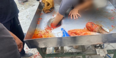 Kız Çocuğu Elini Salça Makinesine Kaptırdı